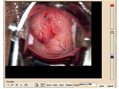 COLPOSCOPY SOFTWARE for Colcoscope 296M20, 296M00 with 296M03