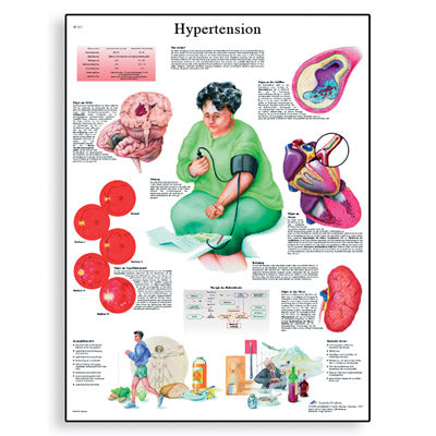 Hypertension Poster