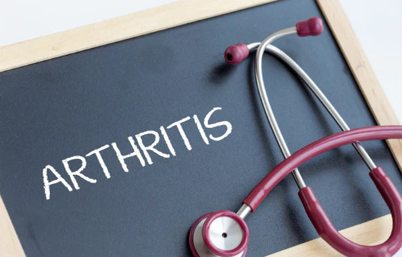 Arthritis