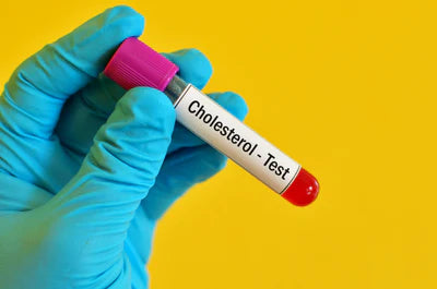 Cholesterol Test